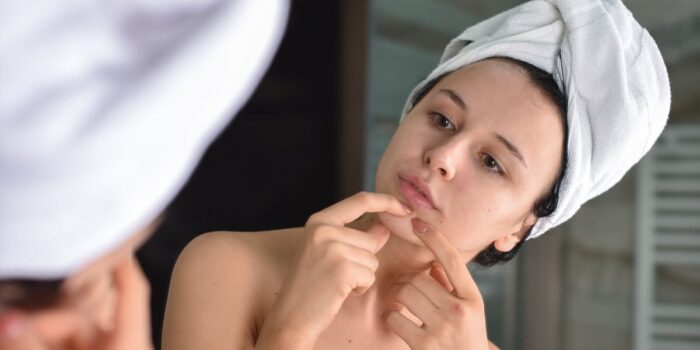 If You’re a Woman with Chin Hair, Here’s What It Could Really Mean