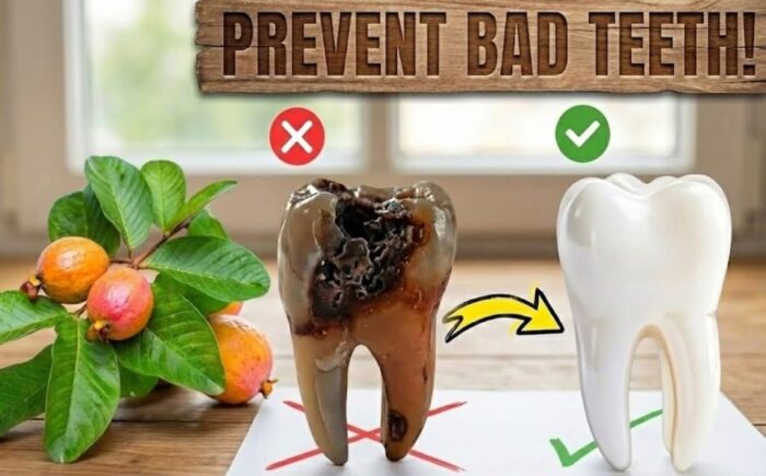 Top 3 Ways to Treat Tooth Decay with Guava Leaves – Simple and Cost-Effective